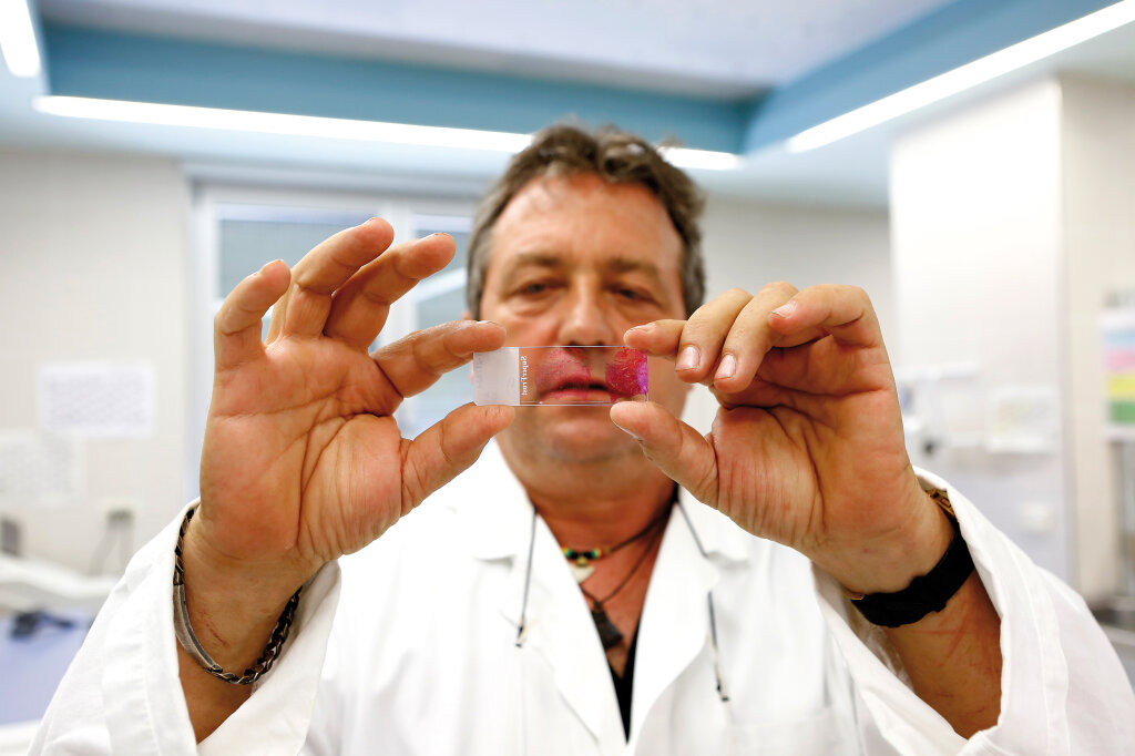 Ist die Probe gut- oder bösartig? Jede Probe wird zunächst in dünne Scheiben geschnitten und auf Glasplättchen gelegt, um sie unter dem Mikroskop untersuchen zu können. „Die Pathologie ist die Grundsäule des Krankenhauses“, sagt Guido Mazzoleni. Foto: Alexander Alber